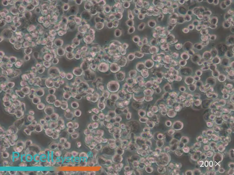 Sf21 Cell Complete Medium - 6