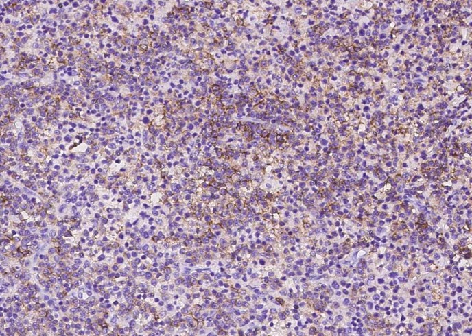 CD10 Monoclonal Antibody - small - 2