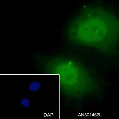Recombinant Caldesmon/CDM Monoclonal Antibody - small - 5