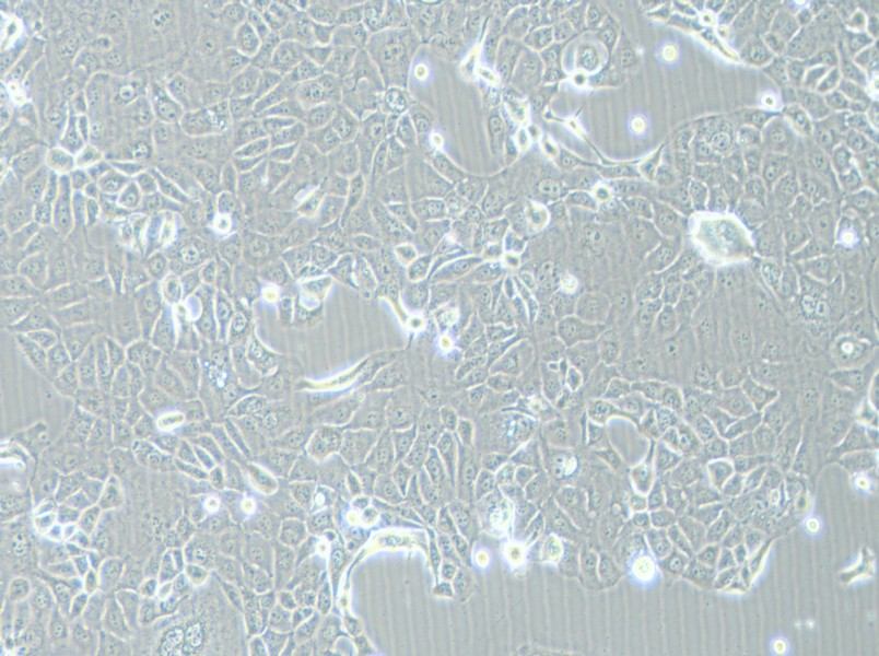 HCC-78 Cell Complete Medium-searchlist-1