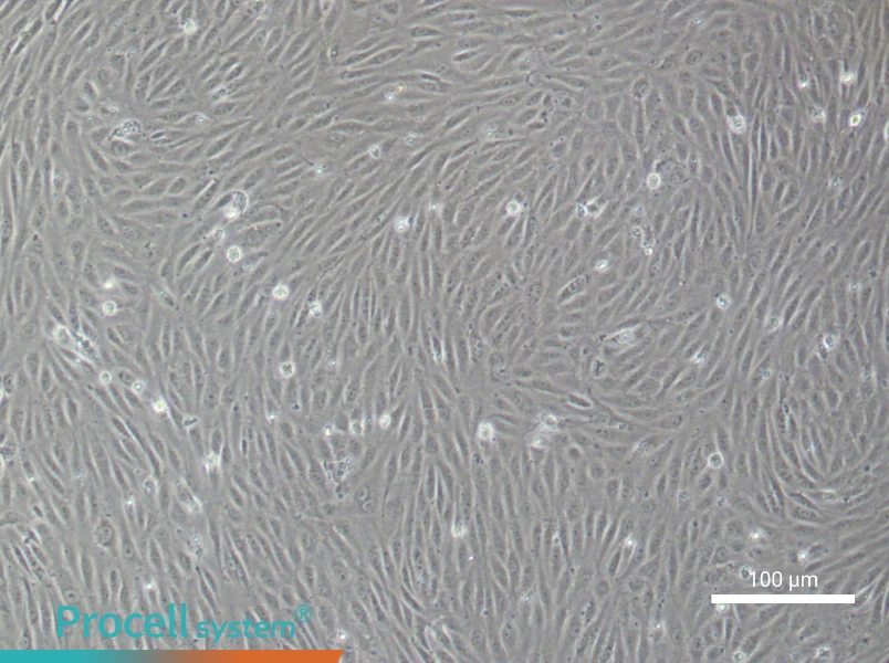 Human Choroidal Microvascular Endothelial Cell Complete Medium - 2