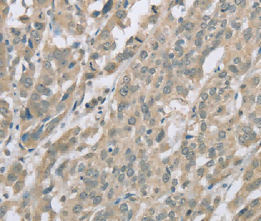 EDA2R Polyclonal Antibody - 3