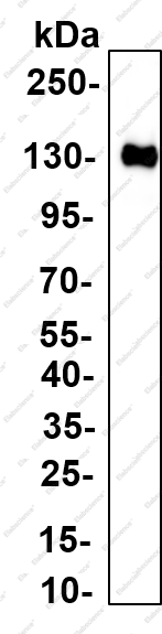 Recombinant LATS1 (Phospho Thr1079) Monoclonal Antibody - 1