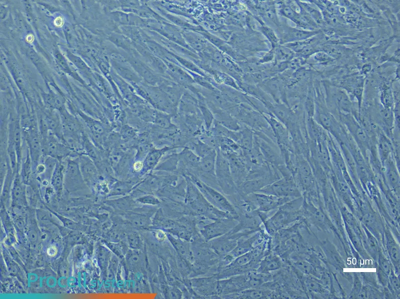 Mouse Uterine Fibroblast Complete Medium - 5