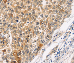 JNK2 Polyclonal Antibody - 3