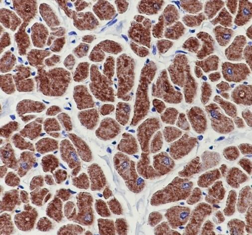 Recombinant CPT1B Monoclonal Antibody-searchlist-2