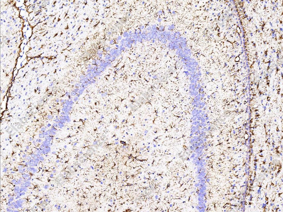 Recombinant GFAP Monoclonal Antibody - 3