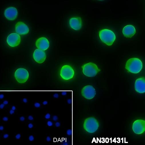 Recombinant ALDOA Monoclonal Antibody - 3