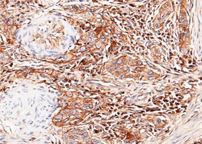 Recombinant B2M/beta-2 microglobulin Monoclonal Antibody - small - 3