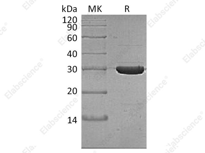 Recombinant Thermobifida fusca Cutinase Protein (His Tag) - 1
