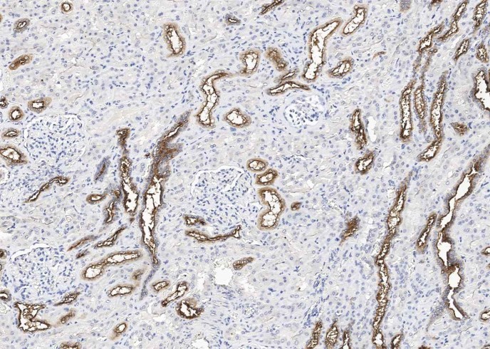 Recombinant MUC1 Monoclonal Antibody - small - 2