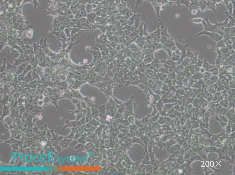 NCCIT Cell Complete Medium - 4