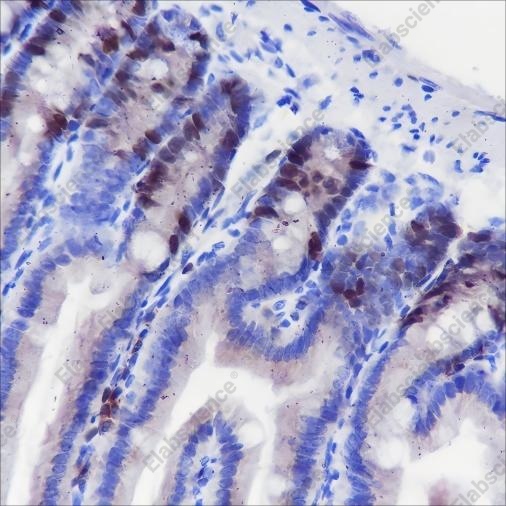 Recombinant TPX2 Monoclonal Antibody - 1