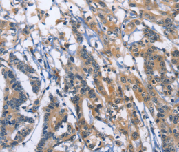 SYT17 Polyclonal Antibody - 3