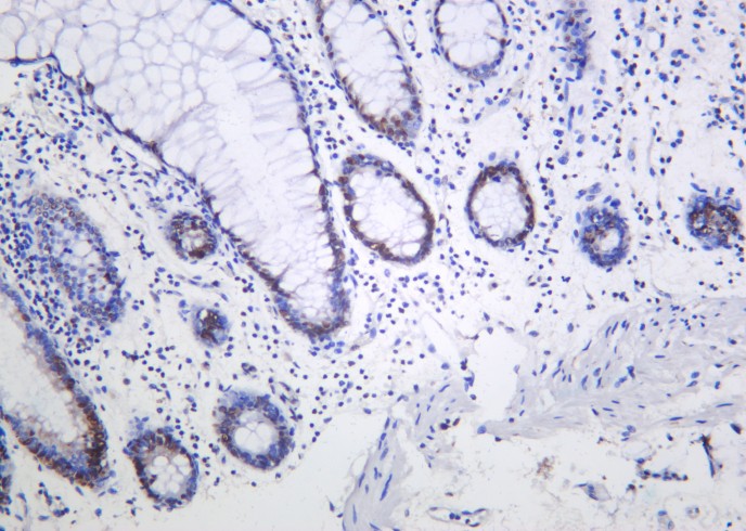 Recombinant Phospho-Rpb1 (Ser5) Monoclonal Antibody - small - 2