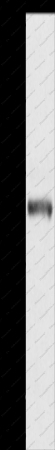 KLC1 Polyclonal Antibody - 1