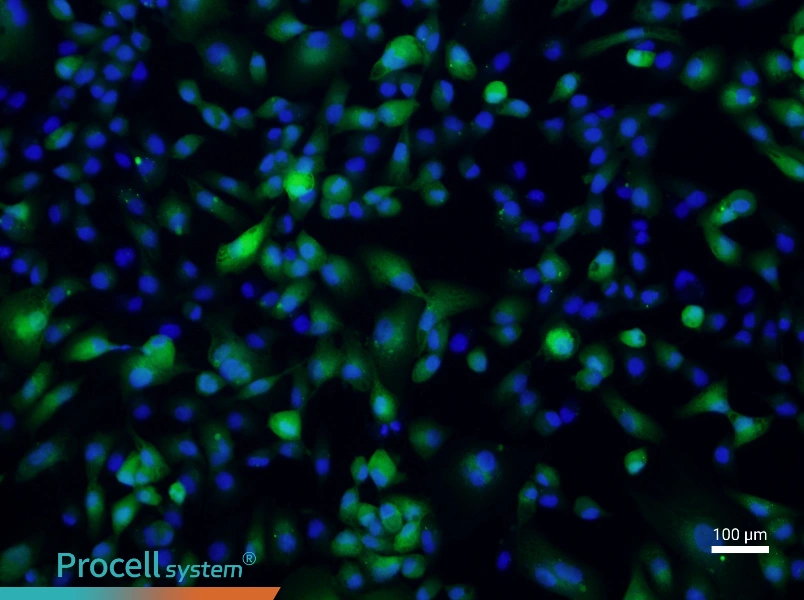 ACHN-GFP - 1