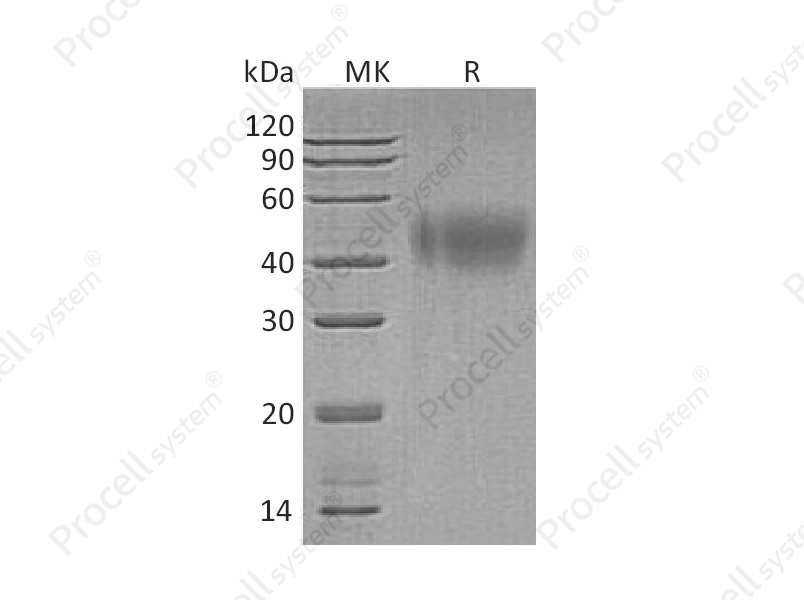 IFNAR2 (C-6His), Human, Recombinant