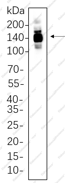 Recombinant HDAC4 Monoclonal Antibody - 1