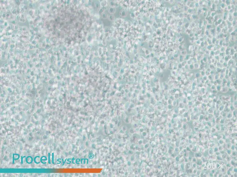 CCRF-SB Cell Complete Medium - 6