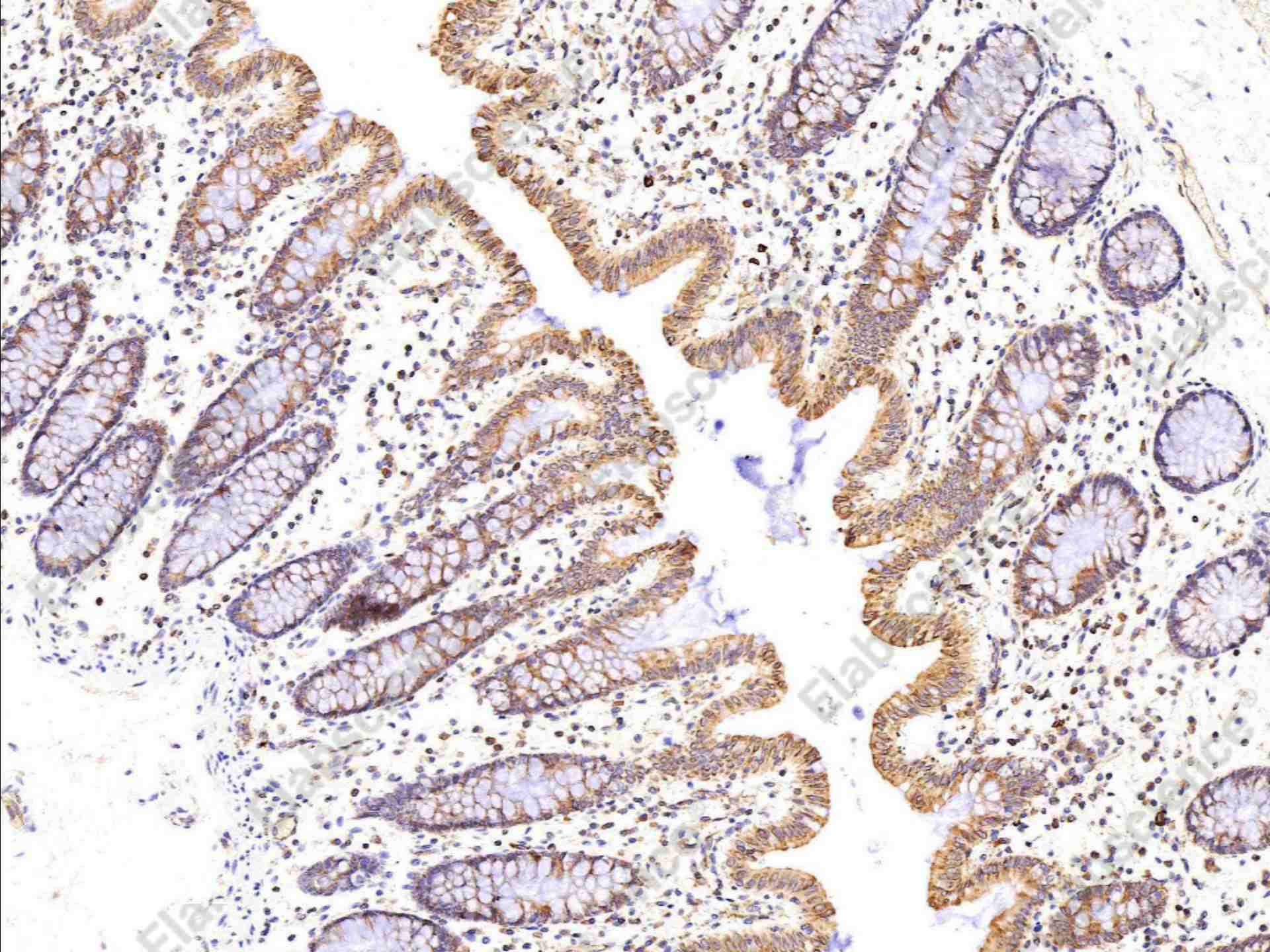 Recombinant ADAM15/MDC15 Monoclonal Antibody - 1