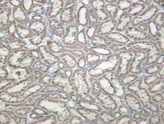Recombinant NDUFB9 Monoclonal Antibody - 4