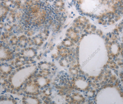 RBMS3 Polyclonal Antibody - 2