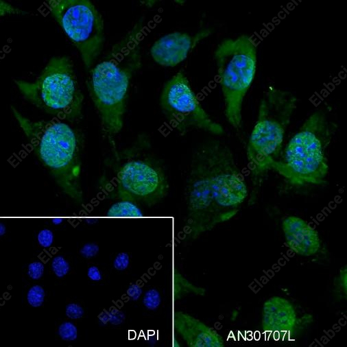 Recombinant S100A1 Monoclonal Antibody - 4