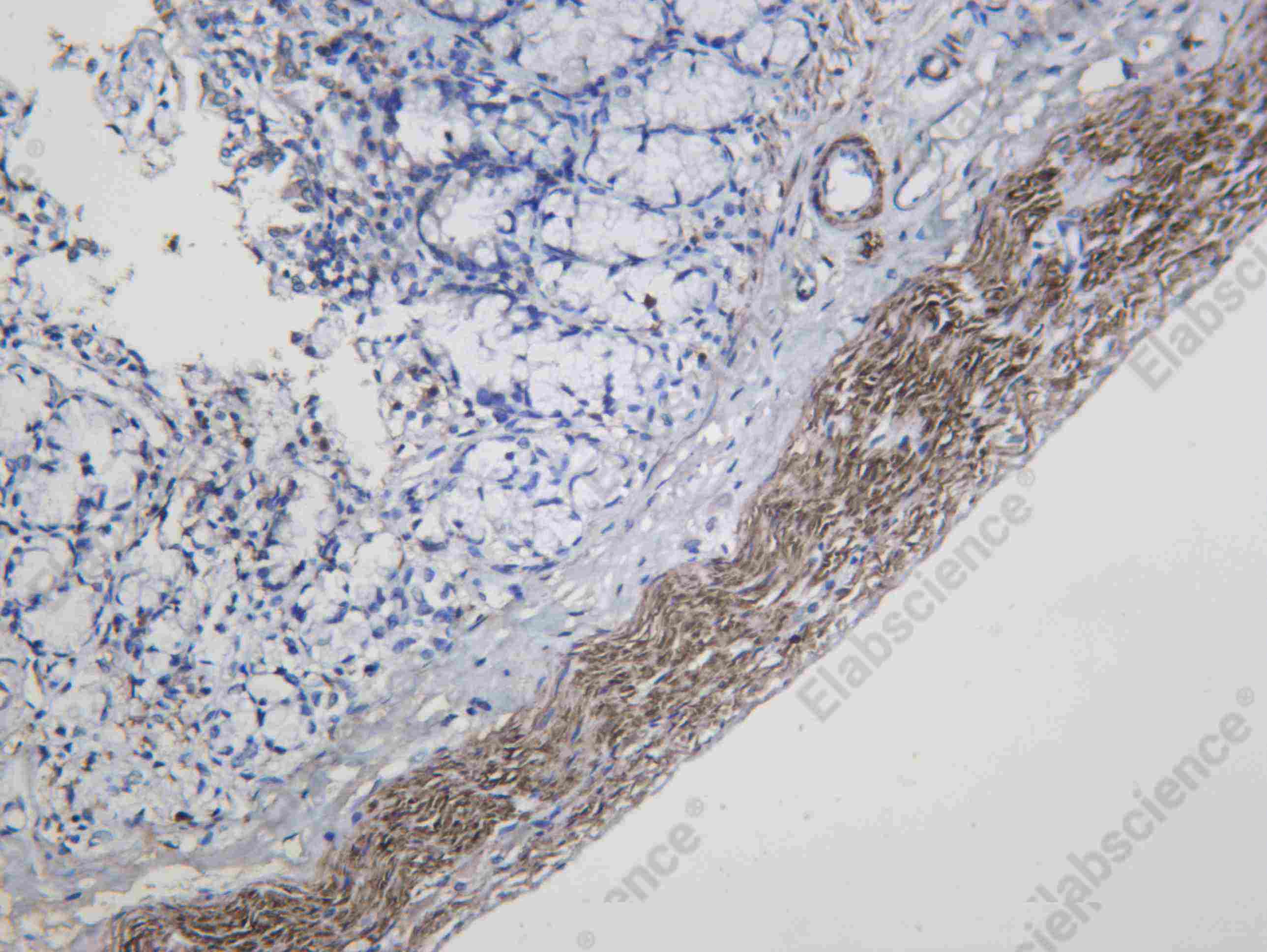 Recombinant SMIF Monoclonal Antibody - 3