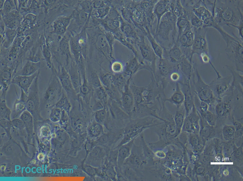 Human Synovial Fibroblast (Primary cell immortalization) Complete MediumHuman Synovial Fibroblast (Primary cell immortalization) Complete Medium - 6