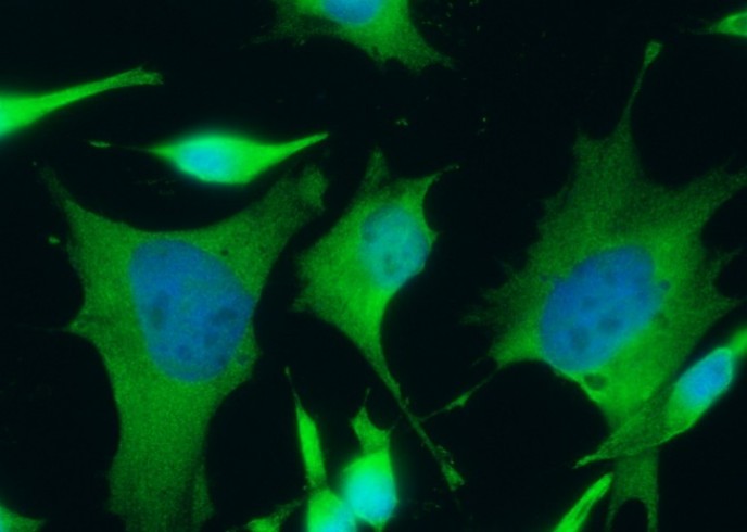 Recombinant FDPS/Farnesyl Diphosphate Synthase Monoclonal Antibody - small - 2