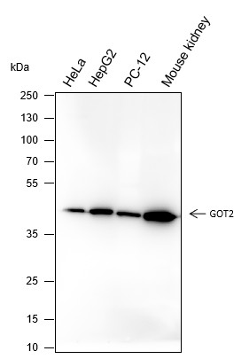 Recombinant GOT2 Monoclonal Antibody-searchlist-1