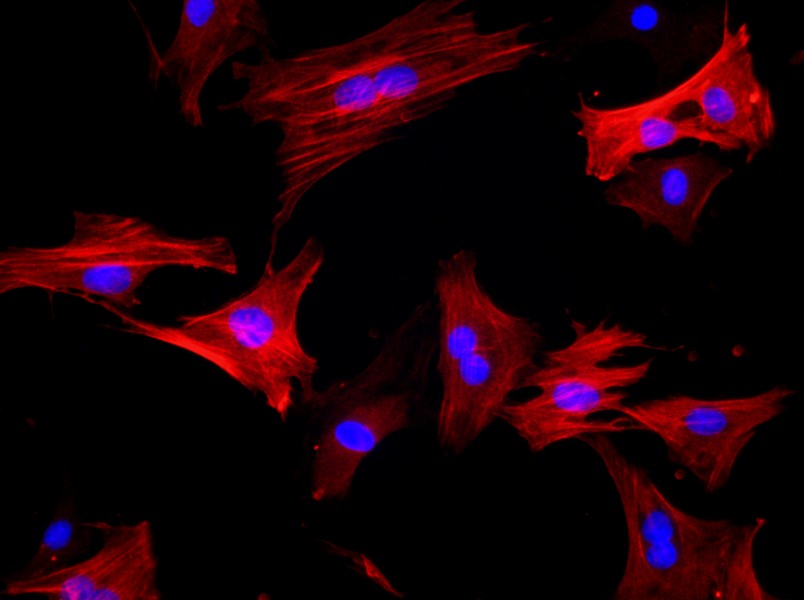 Rat Saphenous Vein Smooth Muscle Cell Complete Medium - 2