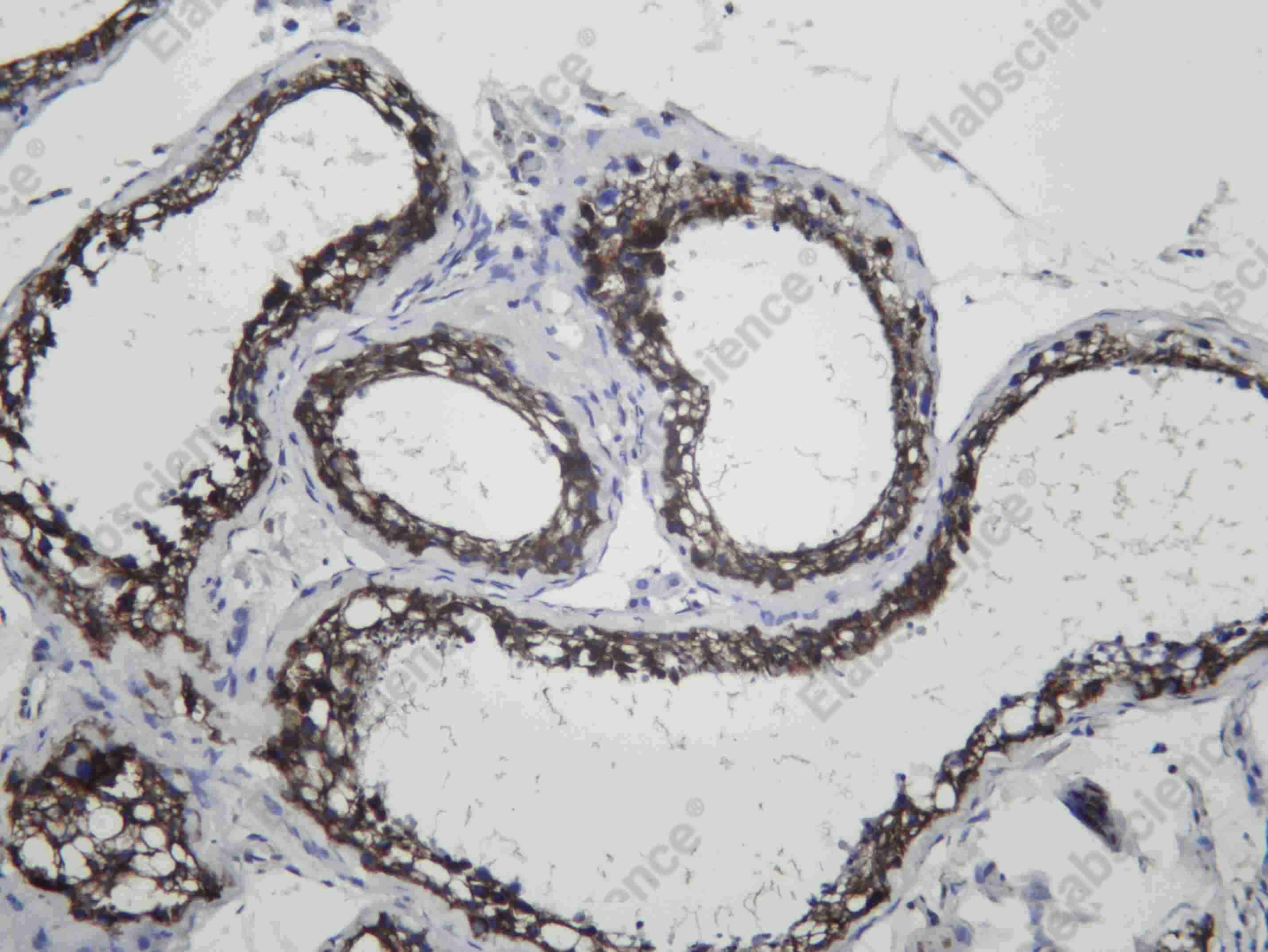 Recombinant MAGE 1 Monoclonal Antibody - 2