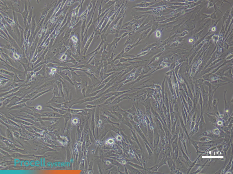 Human Pulmonary Artery Smooth Muscle (Primary cell immortalization) Cell Complete MediumHuman Pulmonary Artery Smooth Muscle (Primary cell immortalization) Cell Complete Medium - 1