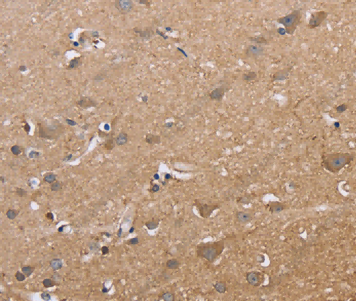 MAPRE3 Polyclonal Antibody - 2