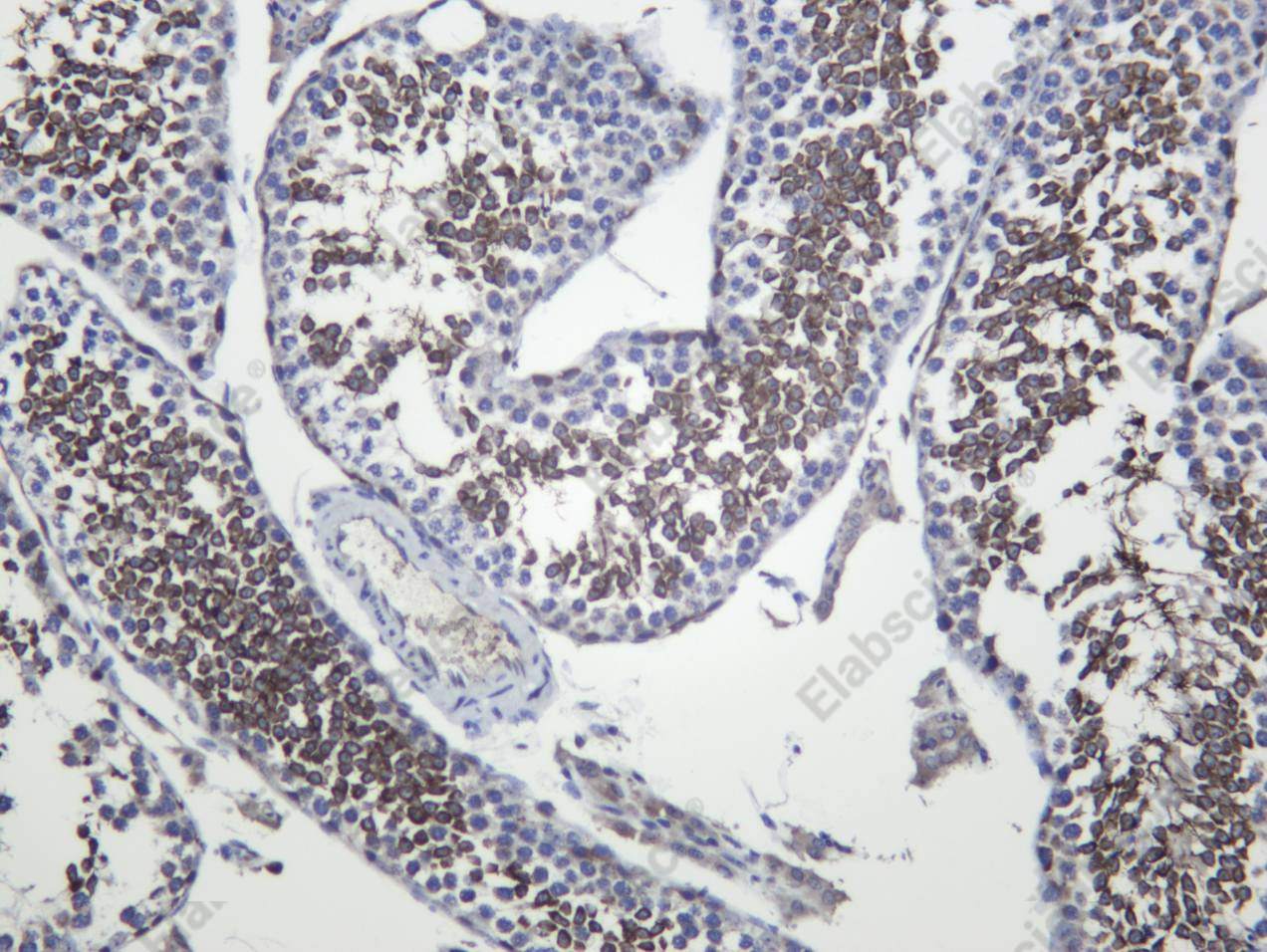 Recombinant MAGE 1 Monoclonal Antibody - 3