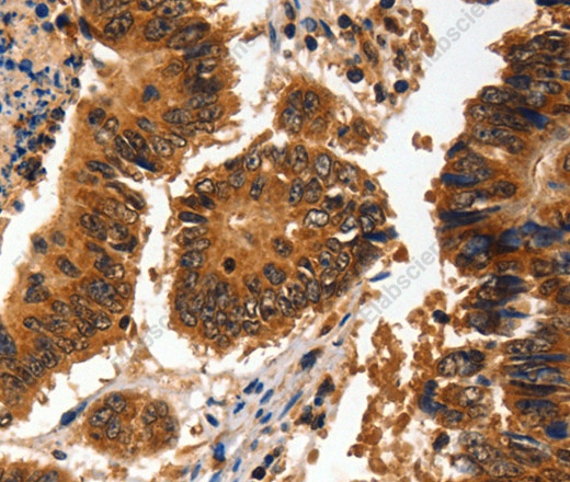 ADAP1 Polyclonal Antibody - 1
