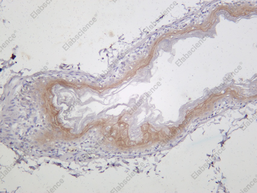 Recombinant Claudin-1 Monoclonal Antibody - 4