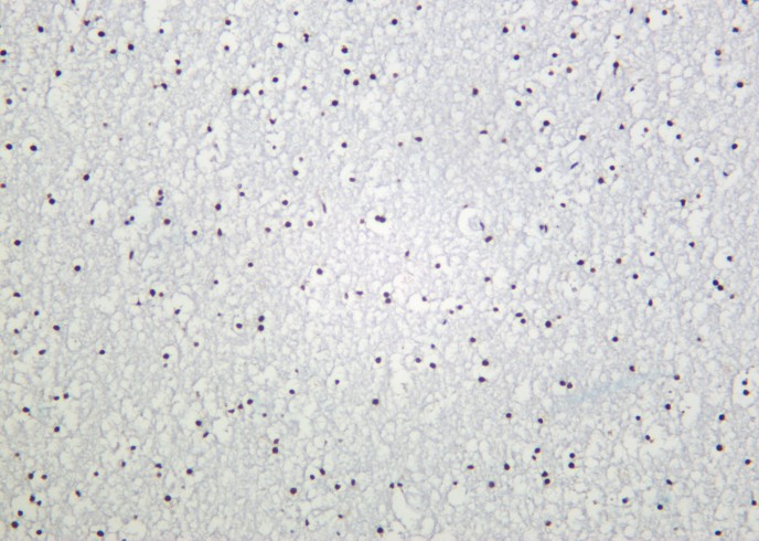 Recombinant Histone H3 (Tri Methyl Lys79) Monoclonal Antibody - small - 2