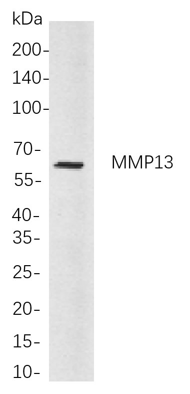 Recombinant MMP13 Monoclonal Antibody-searchlist-1
