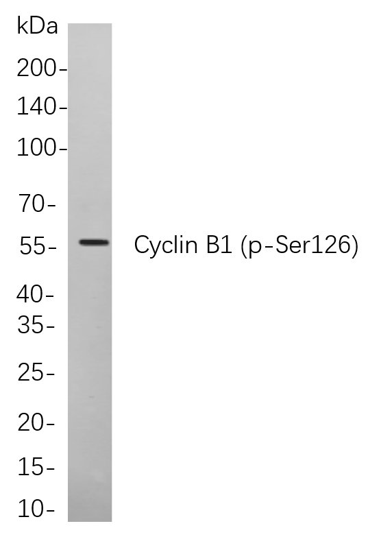 Recombinant Phospho-Cyclin B1 (Ser126) Monoclonal Antibody-searchlist-1