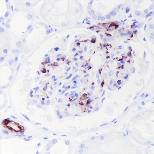 Recombinant Complement C4-B Monoclonal Antibody - small - 2