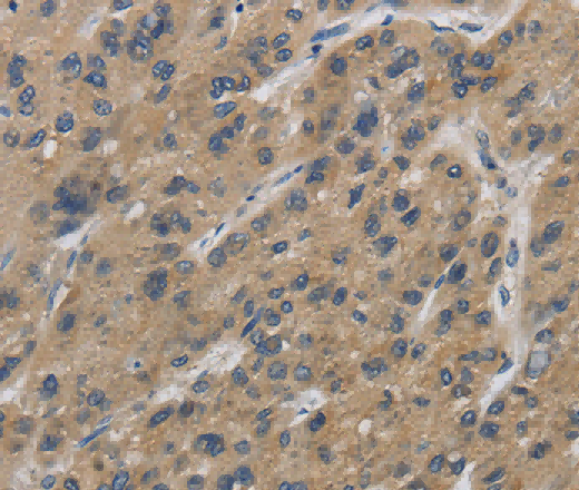 IPO7 Polyclonal Antibody - 3