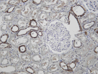 Recombinant LYPLA1 Monoclonal Antibody - 2
