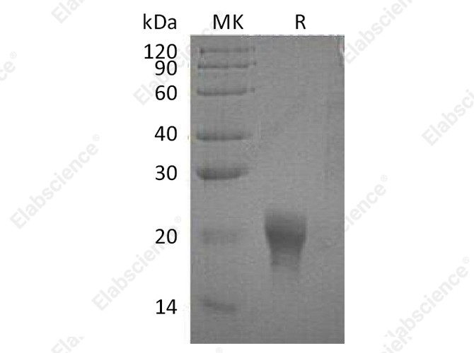 Recombinant Human Interleukin-5/IL-5 Protein (His Tag) - 1