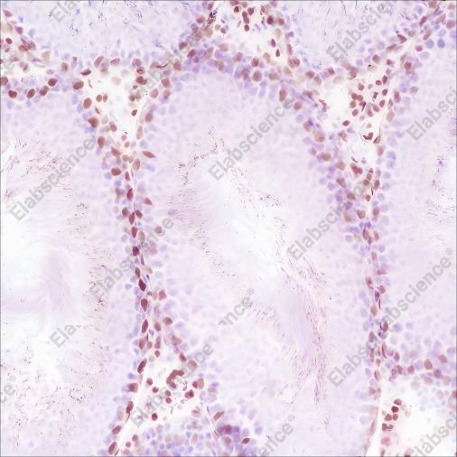 Recombinant Androgen Receptor (CT) Monoclonal Antibody - 5