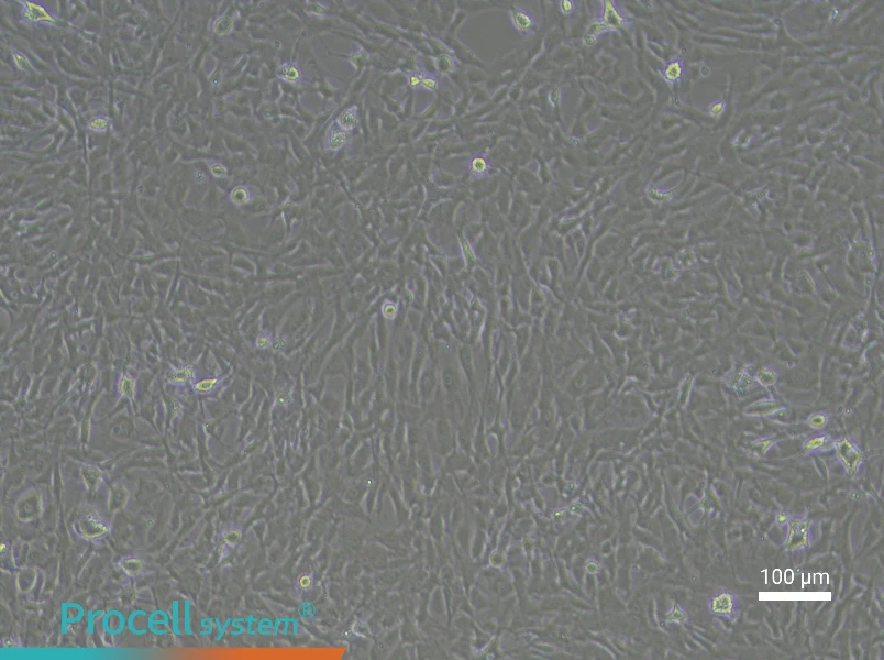 Rat Meningeal Fibroblast Complete Medium - 1