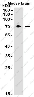 Recombinant Choline Acetyltransferase Monoclonal Antibody - 1