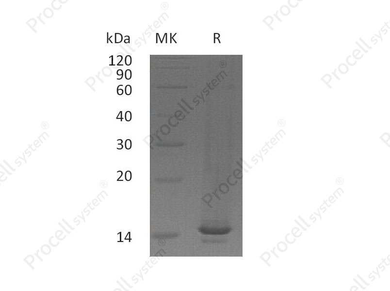 MIP-1&gamma;/CCL9, Mouse, Recombinant